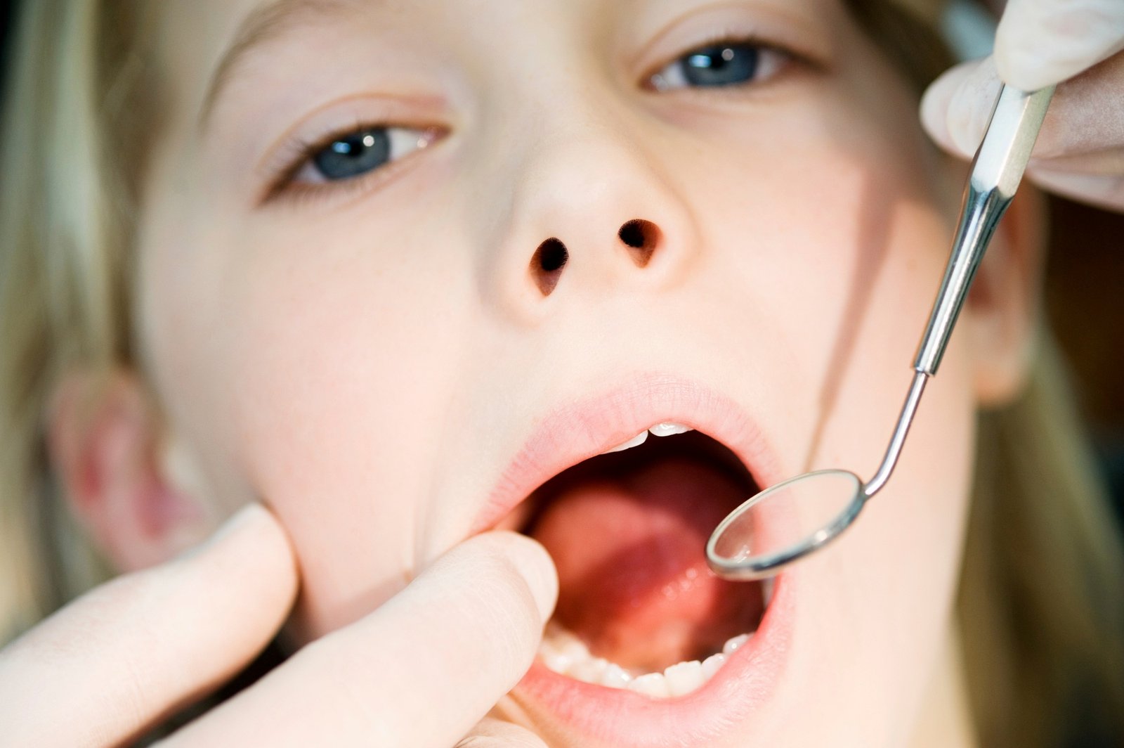 Child at a dental checkup